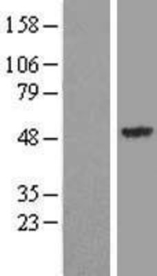 Western Blot: Synaptotagmin 13 Overexpression Lysate (Adult Normal) [NBL1-16649] Left-Empty vector transfected control cell lysate (HEK293 cell lysate); Right -Over-expression Lysate for Synaptotagmin 13.
