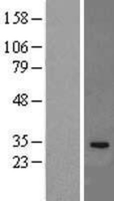 Western Blot: IL33 Overexpression Lysate (Adult Normal) [NBL1-11954] Left-Empty vector transfected control cell lysate (HEK293 cell lysate); Right -Over-expression Lysate for IL33.