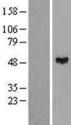 Western Blot: ZNF193 Overexpression Lysate (Adult Normal) [NBL1-18078] Left-Empty vector transfected control cell lysate (HEK293 cell lysate); Right -Over-expression Lysate for ZNF193.