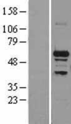 Western Blot: SNRP70 Overexpression Lysate (Adult Normal) [NBL1-16284] Left-Empty vector transfected control cell lysate (HEK293 cell lysate); Right -Over-expression Lysate for SNRP70.