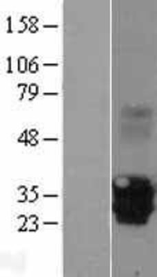 Western Blot: MPZL2 Overexpression Lysate (Adult Normal) [NBL1-13215] Left-Empty vector transfected control cell lysate (HEK293 cell lysate); Right -Over-expression Lysate for MPZL2.