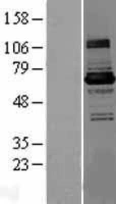 Western Blot: KLHL22 Overexpression Lysate (Adult Normal) [NBL1-12336] Left-Empty vector transfected control cell lysate (HEK293 cell lysate); Right -Over-expression Lysate for KLHL22.