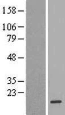 Western Blot: FKBP2 Overexpression Lysate (Adult Normal) [NBL1-10736] Left-Empty vector transfected control cell lysate (HEK293 cell lysate); Right -Over-expression Lysate for FKBP2.
