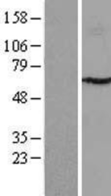 Western Blot: P4HA3 Overexpression Lysate (Adult Normal) [NBL1-14053] Left-Empty vector transfected control cell lysate (HEK293 cell lysate); Right -Over-expression Lysate for P4HA3.