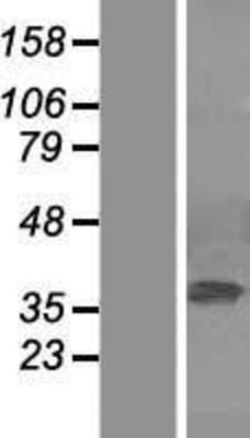 Western Blot: ERK2 Overexpression Lysate (Adult Normal) [NBL1-12865] Left-Empty vector transfected control cell lysate (HEK293 cell lysate); Right -Over-expression Lysate for ERK2.