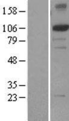 Western Blot: XPF Overexpression Lysate (Adult Normal) [NBL1-10322] Left-Empty vector transfected control cell lysate (HEK293 cell lysate); Right -Over-expression Lysate for XPF.