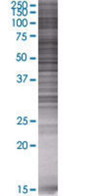 FADS1 transfected lysate.