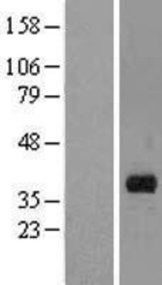 Western Blot: MARCH8 Overexpression Lysate (Adult Normal) [NBL1-07137] Left-Empty vector transfected control cell lysate (HEK293 cell lysate); Right -Over-expression Lysate for MARCH8.