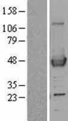 Western Blot: ACAA1 Overexpression Lysate (Adult Normal) [NBL1-07216] Left-Empty vector transfected control cell lysate (HEK293 cell lysate); Right -Over-expression Lysate for ACAA1.