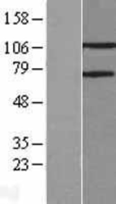 Western Blot: PARG Overexpression Lysate (Adult Normal) [NBL1-14104] Left-Empty vector transfected control cell lysate (HEK293 cell lysate); Right -Over-expression Lysate for PARG.