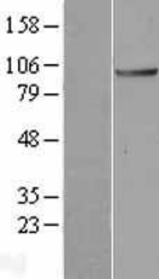Western Blot: ANAPC2 Overexpression Lysate (Adult Normal) [NBL1-07516] Left-Empty vector transfected control cell lysate (HEK293 cell lysate); Right -Over-expression Lysate for ANAPC2.