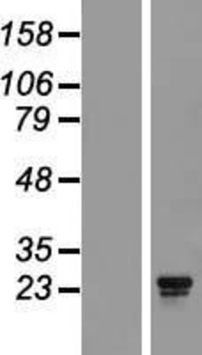 Western Blot: AKIP1/BCA3 Overexpression Lysate (Adult Normal) [NBL1-08096] Left-Empty vector transfected control cell lysate (HEK293 cell lysate); Right -Over-expression Lysate for AKIP1/BCA3.