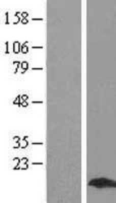 Western Blot: MYL9 Overexpression Lysate (Adult Normal) [NBL1-13430] Left-Empty vector transfected control cell lysate (HEK293 cell lysate); Right -Over-expression Lysate for MYL9.