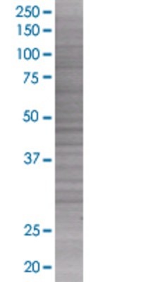 Western Blot: RPA2 Lysate [H00006118-T02]-RPA2 transfected lysate