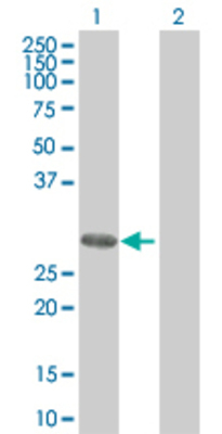 Western Blot: RPA2 Lysate [H00006118-T02] - Lane 1: RPA2 transfected lysate (29.2 KDa) Lane 2: Non-transfected lysate.