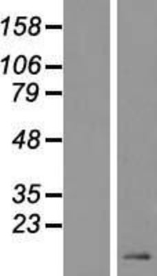 Western Blot: DEFB119 Overexpression Lysate (Adult Normal) [NBL1-09823] Left-Empty vector transfected control cell lysate (HEK293 cell lysate); Right -Over-expression Lysate for DEFB119.