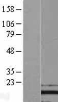 Western Blot: PFDN2 Overexpression Lysate (Adult Normal) [NBL1-14307] Left-Empty vector transfected control cell lysate (HEK293 cell lysate); Right -Over-expression Lysate for PFDN2.