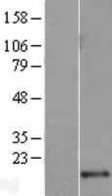 Western Blot: LSM10 Overexpression Lysate (Adult Normal) [NBL1-12721] Left-Empty vector transfected control cell lysate (HEK293 cell lysate); Right -Over-expression Lysate for LSM10.