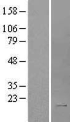 Western Blot: IL2 Overexpression Lysate (Adult Normal) [NBL1-11937] Left-Empty vector transfected control cell lysate (HEK293 cell lysate); Right -Over-expression Lysate for IL2.