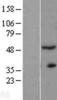 Western Blot: ACTR3B Overexpression Lysate (Adult Normal) [NBL1-07289] Left-Empty vector transfected control cell lysate (HEK293 cell lysate); Right -Over-expression Lysate for ACTR3B.
