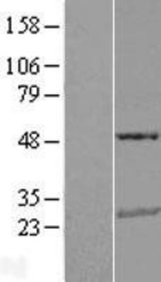 Western Blot: TRAIL Overexpression Lysate (Adult Normal) [NBL1-17161] Left-Empty vector transfected control cell lysate (HEK293 cell lysate); Right -Over-expression Lysate for TRAIL.