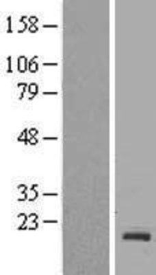 Western Blot: Rac1 Overexpression Lysate (Adult Normal) [NBL1-15104] Left-Empty vector transfected control cell lysate (HEK293 cell lysate); Right -Over-expression Lysate for Rac1.