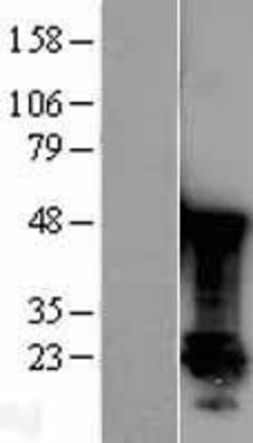 Western Blot: Park7(DJ-1) Overexpression Lysate (Adult Normal) [NBL1-14106] Left-Empty vector transfected control cell lysate (HEK293 cell lysate); Right -Over-expression Lysate for Park7(DJ-1).