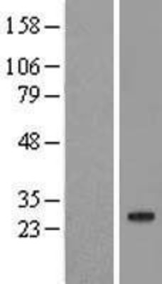 Western Blot: CBLN2 Overexpression Lysate (Adult Normal) [NBL1-08740] Left-Empty vector transfected control cell lysate (HEK293 cell lysate); Right -Over-expression Lysate for CBLN2.