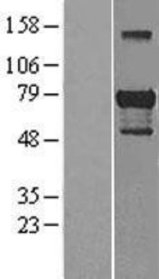 Western Blot: Gata6 Overexpression Lysate (Adult Normal) [NBL1-10984] Left-Empty vector transfected control cell lysate (HEK293 cell lysate); Right -Over-expression Lysate for Gata6.