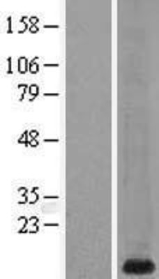 Western Blot: Metallothionein-1G Overexpression Lysate (Adult Normal) [NBL1-13345] Left-Empty vector transfected control cell lysate (HEK293 cell lysate); Right -Over-expression Lysate for Metallothionein-1G.