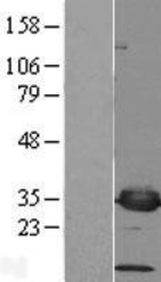 Western Blot: PSMF1 Overexpression Lysate (Adult Normal) [NBL1-14910] Left-Empty vector transfected control cell lysate (HEK293 cell lysate); Right -Over-expression Lysate for PSMF1.