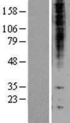 Western Blot: Proteasome beta 1 Overexpression Lysate (Adult Normal) [NBL1-14876] Left-Empty vector transfected control cell lysate (HEK293 cell lysate); Right -Over-expression Lysate for Proteasome beta 1.