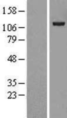 Western Blot: USP38 Overexpression Lysate (Adult Normal) [NBL1-17661] Left-Empty vector transfected control cell lysate (HEK293 cell lysate); Right -Over-expression Lysate for USP38.