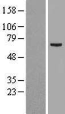 Western Blot: SPATA7 Overexpression Lysate (Adult Normal) [NBL1-16384] Left-Empty vector transfected control cell lysate (HEK293 cell lysate); Right -Over-expression Lysate for SPATA7.