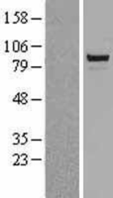 Western Blot: TLE 1 Overexpression Lysate (Adult Normal) [NBL1-16944] Left-Empty vector transfected control cell lysate (HEK293 cell lysate); Right -Over-expression Lysate for TLE 1.