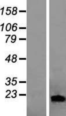Western Blot: Lipocalin-1 Overexpression Lysate (Adult Normal) [NBL1-12462] Left-Empty vector transfected control cell lysate (HEK293 cell lysate); Right -Over-expression Lysate for Lipocalin-1.