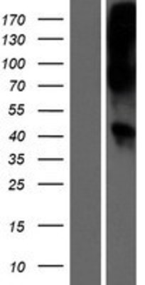 Western Blot: Wnt16 Overexpression Lysate (Adult Normal) [NBL1-17864] Left-Empty vector transfected control cell lysate (HEK293 cell lysate); Right -Over-expression Lysate for Wnt16.