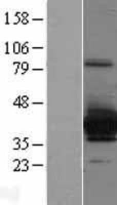 Western Blot: SULT4A1 Overexpression Lysate (Adult Normal) [NBL1-16609] Left-Empty vector transfected control cell lysate (HEK293 cell lysate); Right -Over-expression Lysate for SULT4A1.
