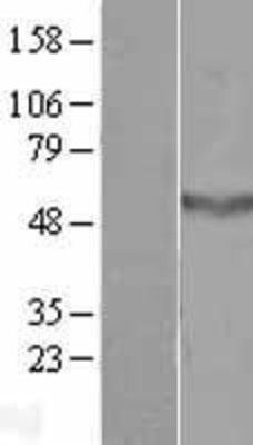 Western Blot: CCDC78 Overexpression Lysate (Adult Normal) [NBL1-08823] Left-Empty vector transfected control cell lysate (HEK293 cell lysate); Right -Over-expression Lysate for CCDC78.