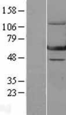Western Blot: GTP binding protein era homolog Overexpression Lysate (Adult Normal) [NBL1-10309] Left-Empty vector transfected control cell lysate (HEK293 cell lysate); Right -Over-expression Lysate for GTP binding protein era homolog.