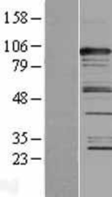 Western Blot: CASC3 Overexpression Lysate (Adult Normal) [NBL1-08701] Left-Empty vector transfected control cell lysate (HEK293 cell lysate); Right -Over-expression Lysate for CASC3.