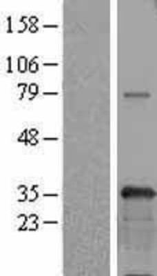 Western Blot: USF1 Overexpression Lysate (Adult Normal) [NBL1-17638] Left-Empty vector transfected control cell lysate (HEK293 cell lysate); Right -Over-expression Lysate for USF1.