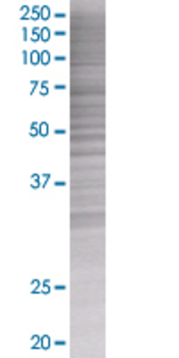 SH2D1A transfected lysate.
