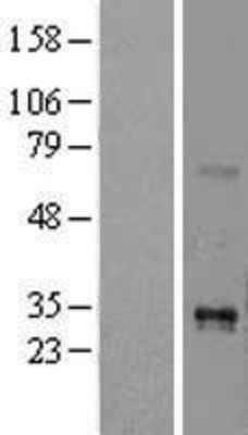 Western Blot: TNFSF15 Overexpression Lysate (Adult Normal) [NBL1-17167] Left-Empty vector transfected control cell lysate (HEK293 cell lysate); Right -Over-expression Lysate for TNFSF15.