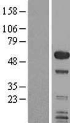 Western Blot: SMAP1 Overexpression Lysate (Adult Normal) [NBL1-16226] Left-Empty vector transfected control cell lysate (HEK293 cell lysate); Right -Over-expression Lysate for SMAP1.