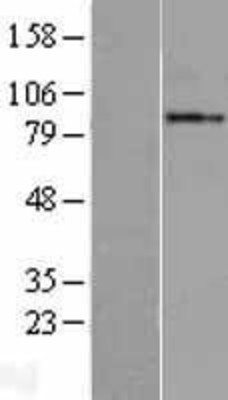 Western Blot: GGCX Overexpression Lysate (Adult Normal) [NBL1-11056] Left-Empty vector transfected control cell lysate (HEK293 cell lysate); Right -Over-expression Lysate for GGCX.