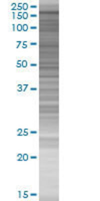 MYBBP1A transfected lysate.