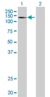 Lane 1: MYBBP1A transfected lysate (148.9 KDa) Lane 2: Non-transfected lysate.