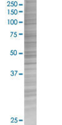 TLR2 transfected lysate.