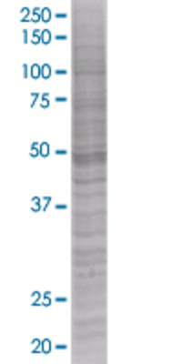 DCTN2 transfected lysate